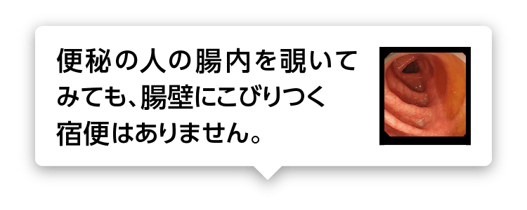 便秘の人の腸内を覗いてみても、腸壁にこびりつく宿便はありません。